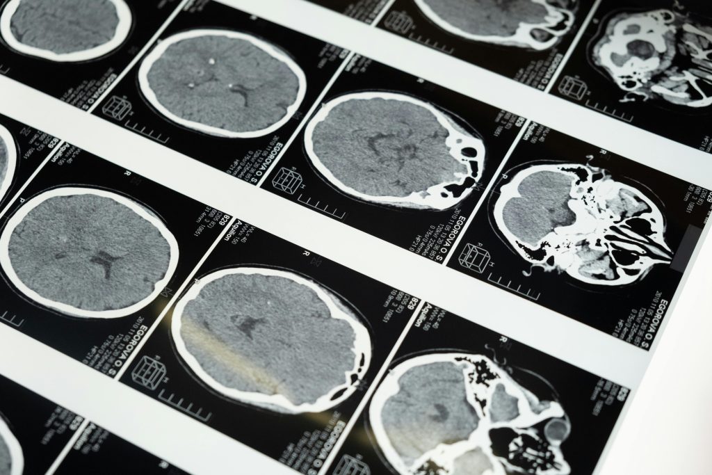 neuroimaging