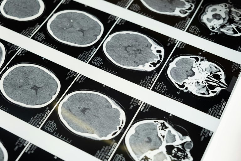 neuroimaging
